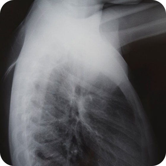 Результат 1