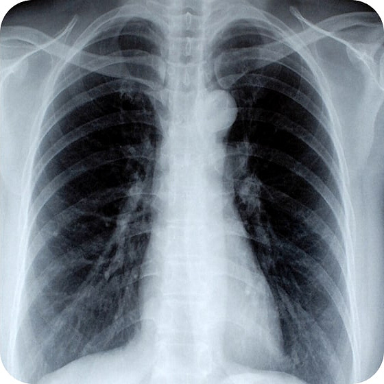 Результат 1